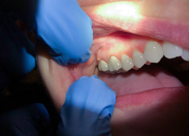 Professional Emergency Dental Service in IL